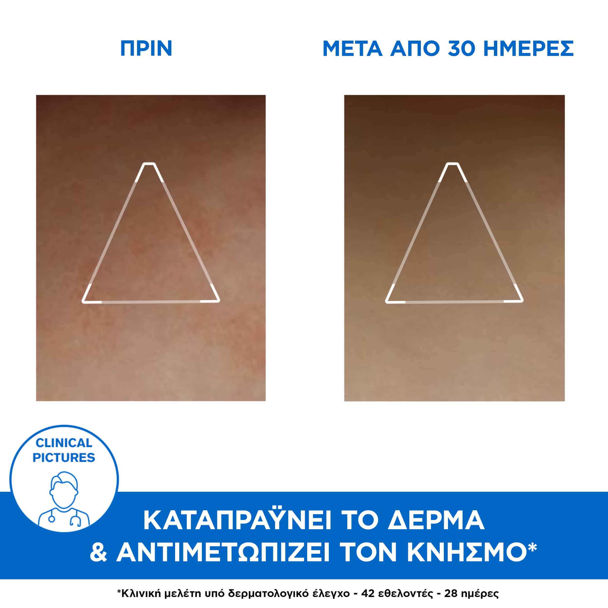 URIAGE - XEMOSE Cerat Relipidant Anti Irritations - 200ml